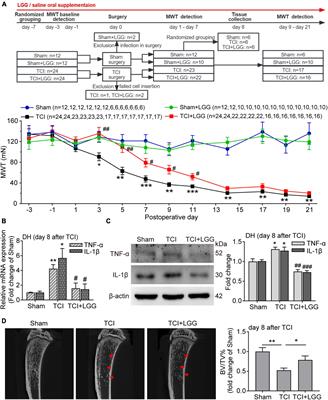 Lactobacillus rhamnosus GG and butyrate supplementation in rats with bone cancer reduces mechanical allodynia and increases expression of μ-opioid receptor in the spinal cord